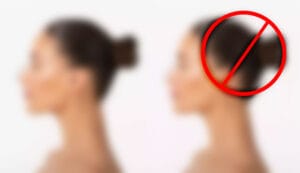 Sosyal Medyada ‘Öncesi-Sonrası’ Paylaşımlar Artık Yasak